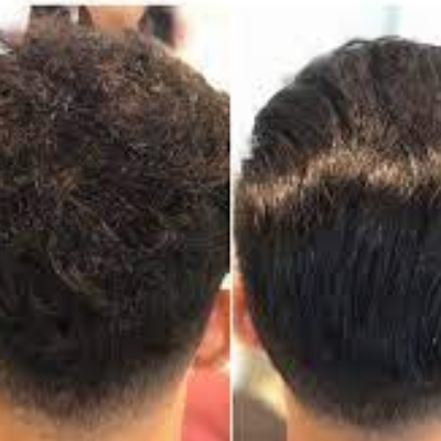 Rebonding